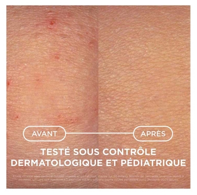 Bioderma Atoderm AD Intensive Baume Relipidant Peau Très Sèche à Atopique 400 ml