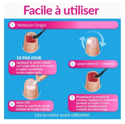 Excilor Forte Traitement Mycose de l'Ongle Coloré + Vernis Classique Coloré Avec Pinceau Applicateur 30 ml