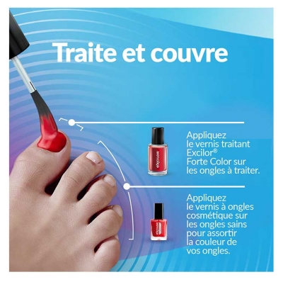 Excilor Forte Traitement Mycose de l'Ongle Coloré + Vernis Classique Coloré Avec Pinceau Applicateur 30 ml