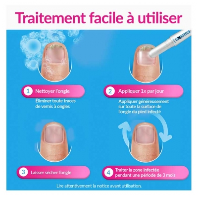 Excilor Easy Traitement Mycose de l'Ongle et Déjaunissement Actif 4 ML