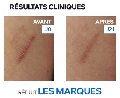 Uriage Bariéderm Cica + Crème Réparatrice Marques Cicatricielles 40 ml